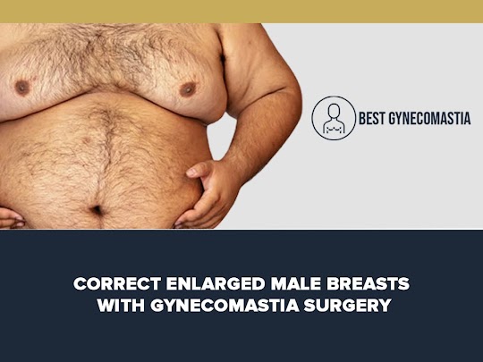 Do You Know About Gynecomastia Conditions? by Deepak Khanduri - Illustrated by Deepak Khanduri - Ourboox.com