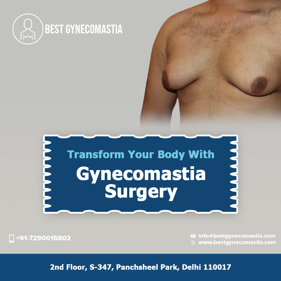 gynecomastia